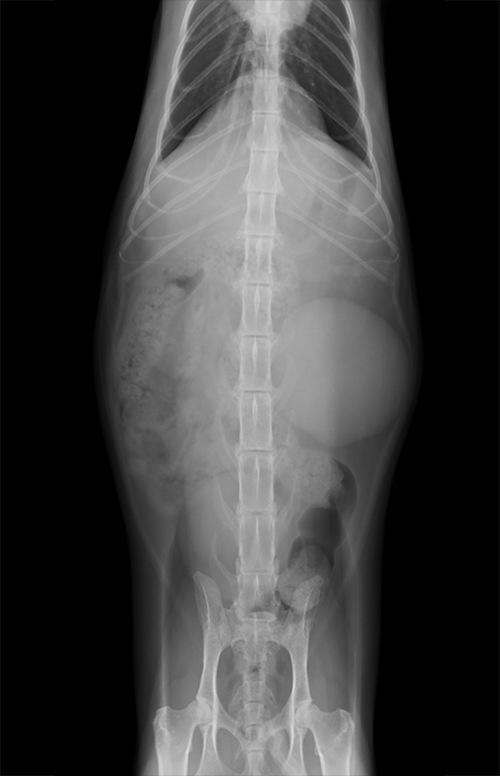 腎細胞癌 腹部X線画像