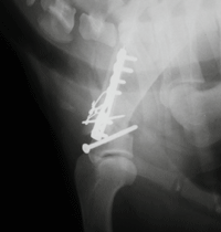 犬の肩甲骨頚部骨折